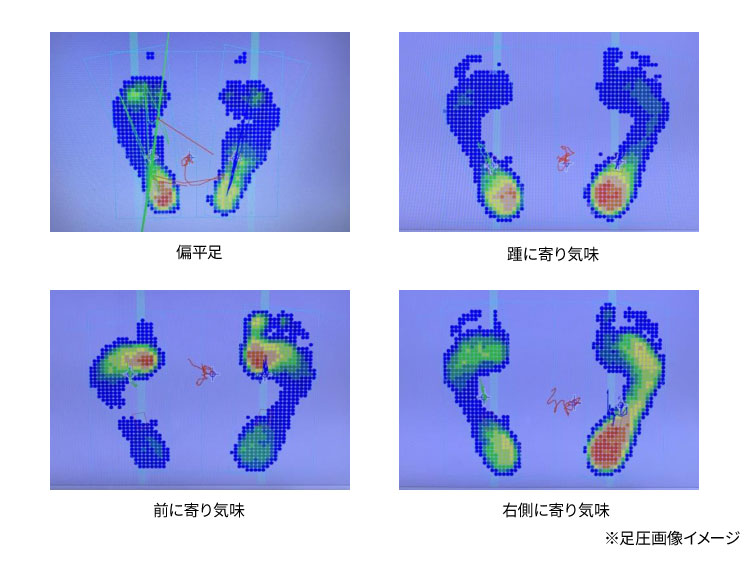 足圧画像イメージ