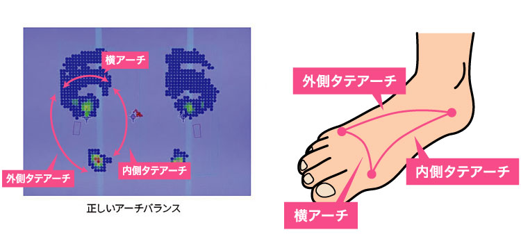 正しいアーチバランス